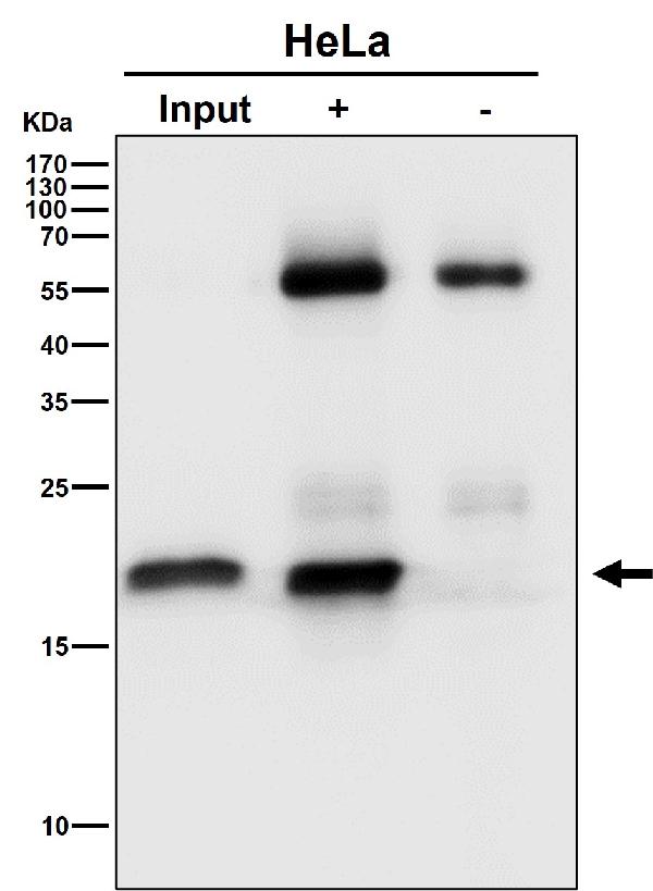 1 - Anti-EMC4 Rabbit Monoclonal Antibody ABO16496