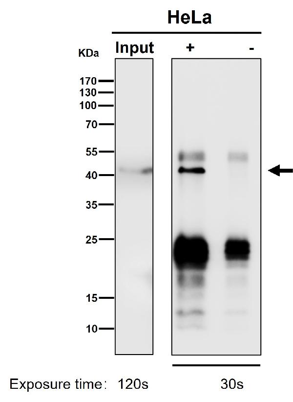 1 - Anti-DNAJA4 Rabbit Monoclonal Antibody ABO16499