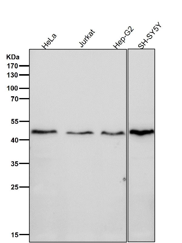 1 - Anti-DNAJA4 Rabbit Monoclonal Antibody ABO16499