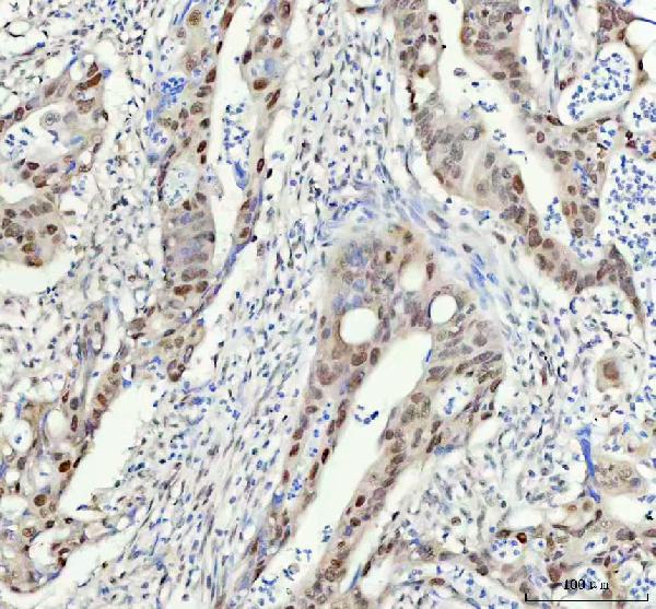 2 - Anti-FAM50A Rabbit Monoclonal Antibody ABO16500