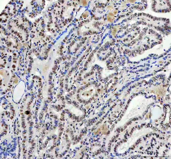 2 - Anti-FAM50A Rabbit Monoclonal Antibody ABO16500
