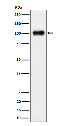 1 - Anti-Nesprin3 Rabbit Monoclonal Antibody ABO16501