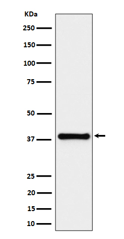 1 - Anti-UCHL5IP Rabbit Monoclonal Antibody ABO16502