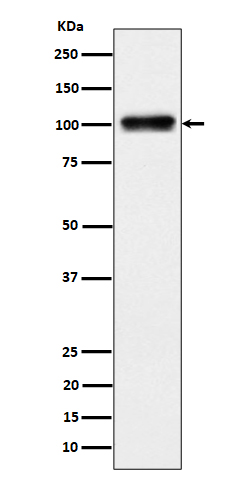1 - Anti-Nesprin3 Rabbit Monoclonal Antibody ABO16503
