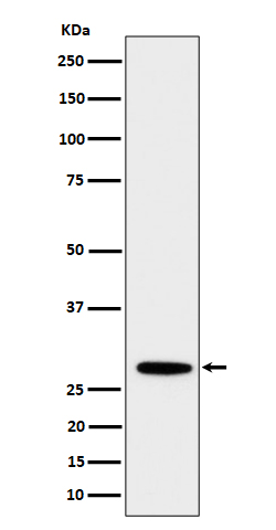 1 - Anti-PSMB10 Rabbit Monoclonal Antibody ABO16505