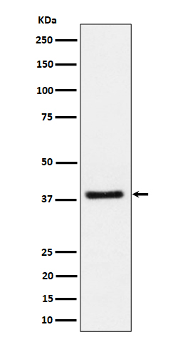 1 - Anti-UCHL5IP Rabbit Monoclonal Antibody ABO16511