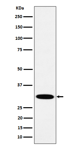 1 - Anti-HMGCL Rabbit Monoclonal Antibody ABO16514