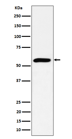 1 - Anti-PRPF4 Rabbit Monoclonal Antibody ABO16516