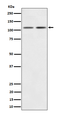 1 - Anti-PI3 Kinase p110 beta Rabbit Monoclonal Antibody ABO16517