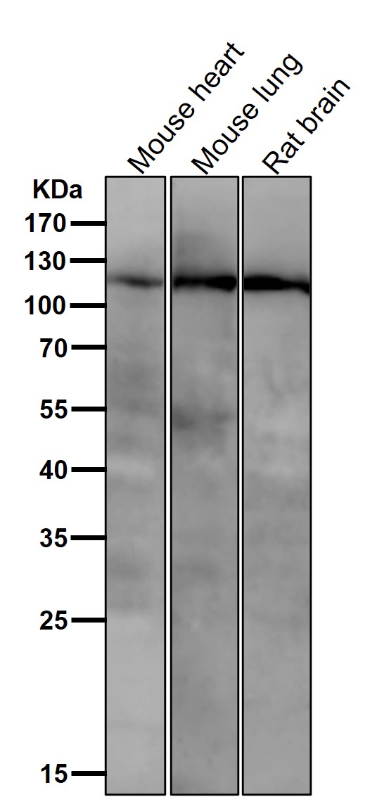 1 - Anti-PI3 Kinase p110 beta Rabbit Monoclonal Antibody ABO16517