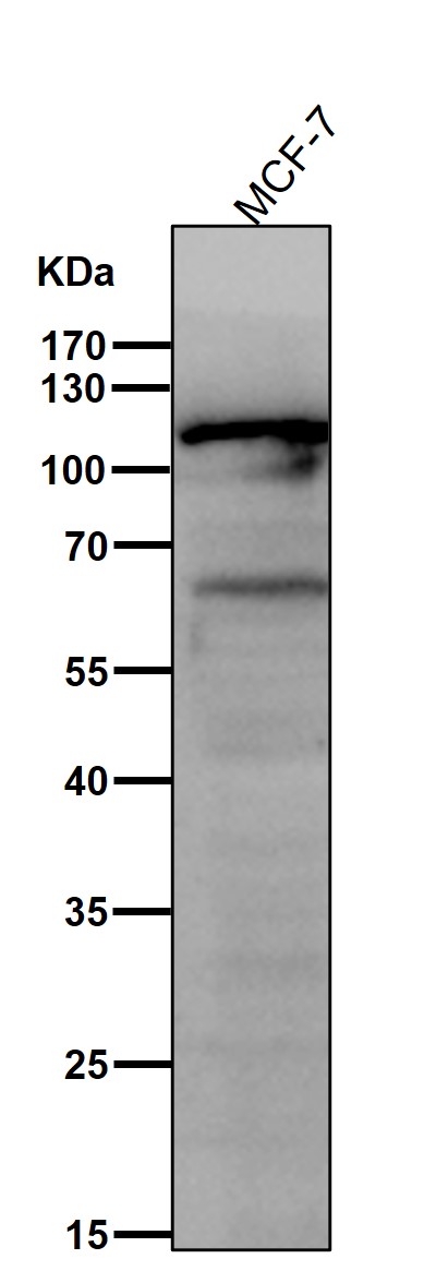 1 - Anti-PI3 Kinase p110 beta Rabbit Monoclonal Antibody ABO16517