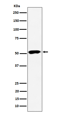 1 - Anti-PPP2R5E Rabbit Monoclonal Antibody ABO16519