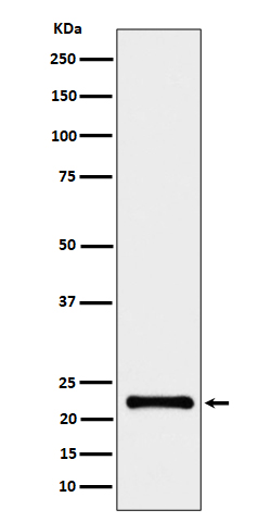 1 - Anti-CRCP Rabbit Monoclonal Antibody ABO16521