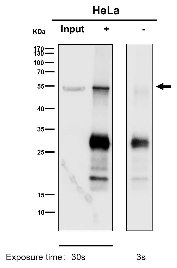 1 - Anti-PPP2R5E Rabbit Monoclonal Antibody ABO16522