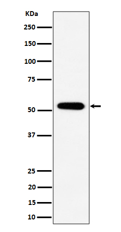 1 - Anti-PPP2R5E Rabbit Monoclonal Antibody ABO16522