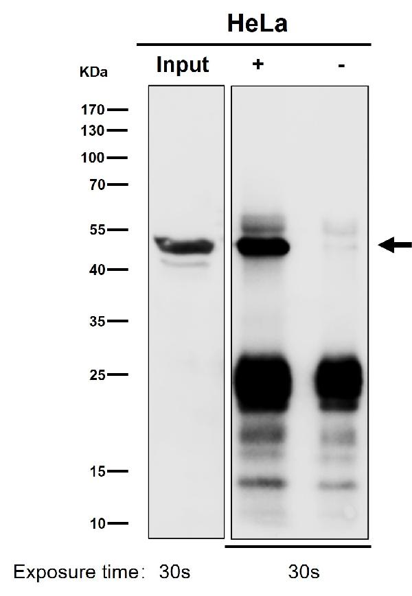 1 - Anti-ACTR1B Rabbit Monoclonal Antibody ABO16523