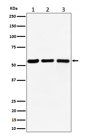 1 - Anti-PRPF4 Rabbit Monoclonal Antibody ABO16524