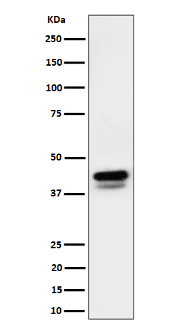 1 - Anti-Phospho-c-Jun (S73)+JunD (S100) Rabbit Monoclonal Antibody ABO16525