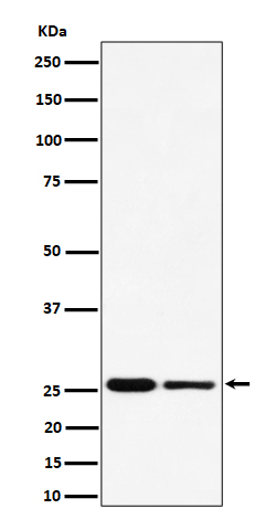 1 - Anti-PMF1 Rabbit Monoclonal Antibody ABO16527