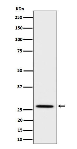 1 - Anti-Adiponectin Rabbit Monoclonal Antibody ABO16528