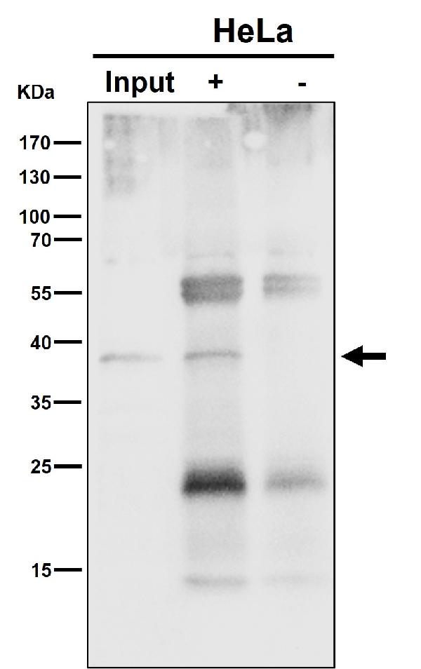 1 - Anti-NSDHL Rabbit Monoclonal Antibody ABO16530