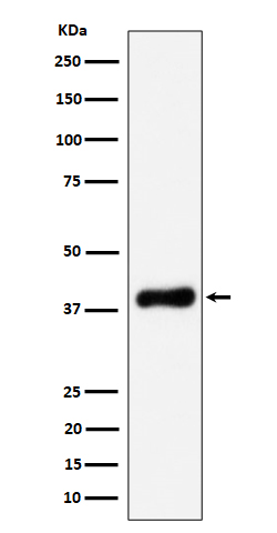 1 - Anti-NSDHL Rabbit Monoclonal Antibody ABO16530