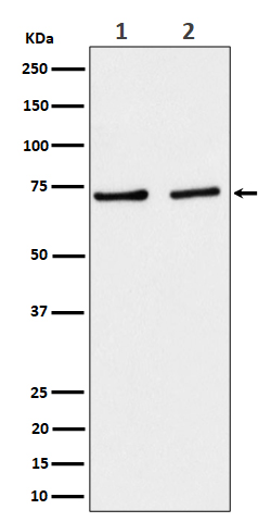 1 - Anti-SLC25A12 Rabbit Monoclonal Antibody ABO16531
