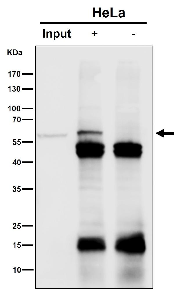 1 - Anti-SLC27A4 Rabbit Monoclonal Antibody ABO16535