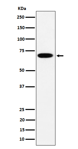 1 - Anti-SLC27A4 Rabbit Monoclonal Antibody ABO16535