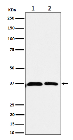 1 - Anti-Serine racemase Rabbit Monoclonal Antibody ABO16537