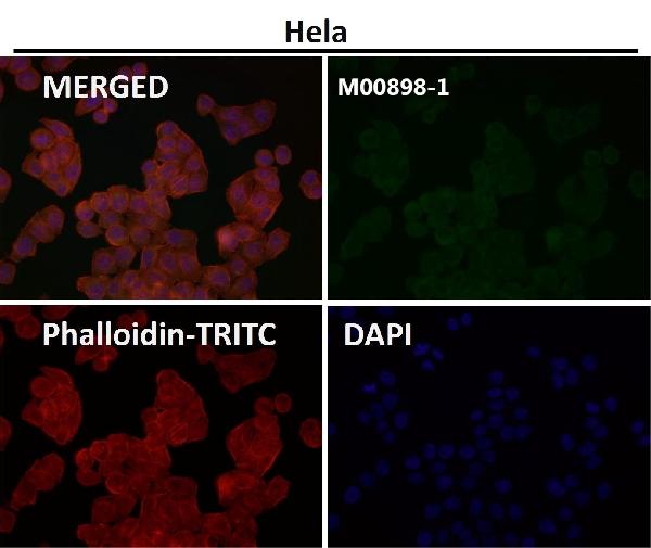 1 - Anti-GNAQ Rabbit Monoclonal Antibody ABO16538