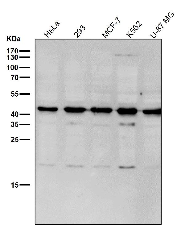 1 - Anti-GNAQ Rabbit Monoclonal Antibody ABO16538