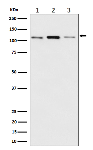 1 - Anti-Meckelin Rabbit Monoclonal Antibody ABO16541