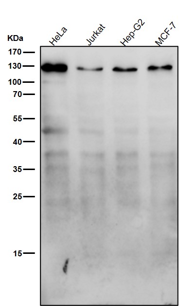 1 - Anti-Meckelin Rabbit Monoclonal Antibody ABO16541