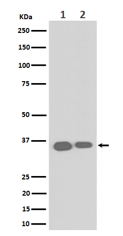 1 - Anti-ELOVL5 Rabbit Monoclonal Antibody ABO16549