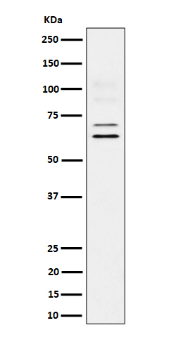 1 - Anti-BIN1 Rabbit Monoclonal Antibody ABO16556