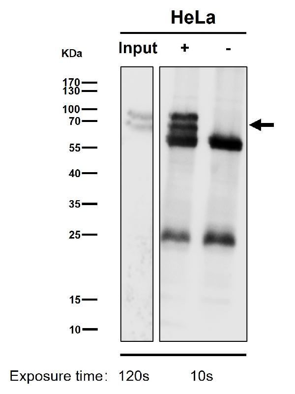 1 - Anti-BIN1 Rabbit Monoclonal Antibody ABO16557