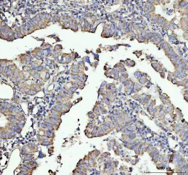 2 - Anti-NDUFAB1 Rabbit Monoclonal Antibody ABO16558