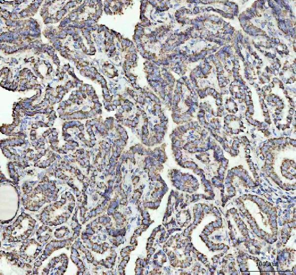 2 - Anti-NDUFAB1 Rabbit Monoclonal Antibody ABO16558