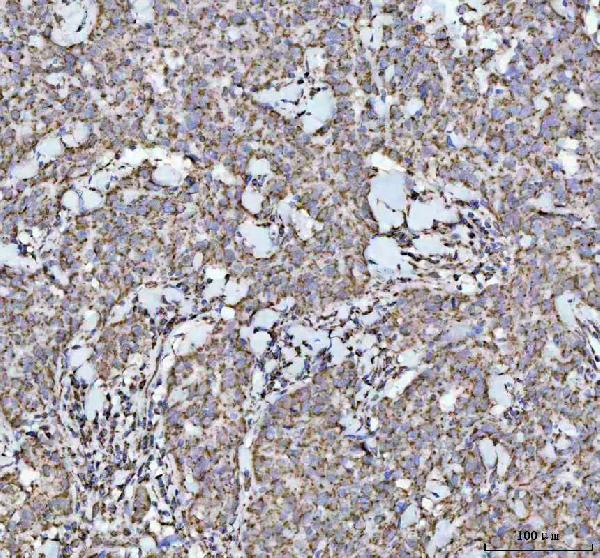 2 - Anti-NDUFAB1 Rabbit Monoclonal Antibody ABO16558