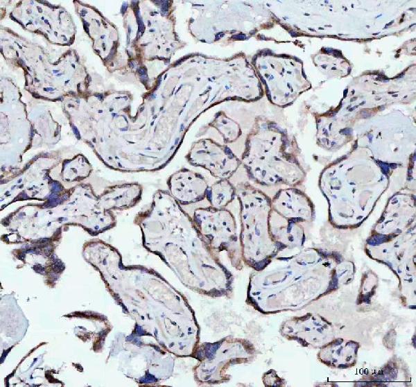 2 - Anti-NDUFAB1 Rabbit Monoclonal Antibody ABO16558