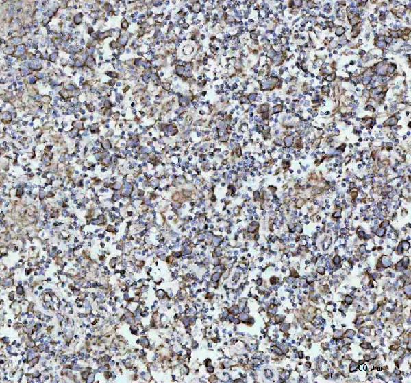 2 - Anti-NDUFAB1 Rabbit Monoclonal Antibody ABO16558