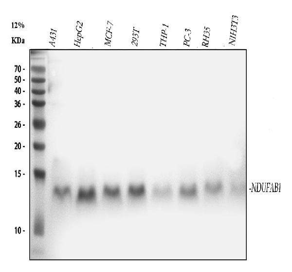 1 - Anti-NDUFAB1 Rabbit Monoclonal Antibody ABO16558