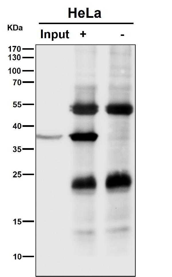 1 - Anti-NMI Rabbit Monoclonal Antibody ABO16559