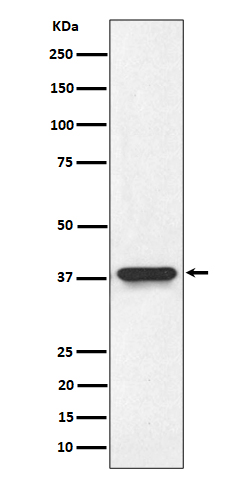 1 - Anti-NMI Rabbit Monoclonal Antibody ABO16559