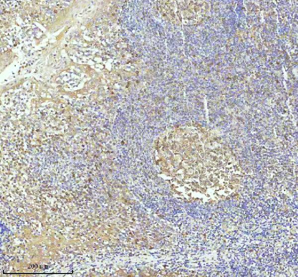 2 - Anti-Caspase 3 Rabbit Monoclonal Antibody ABO16560