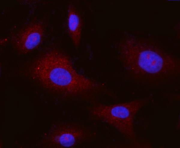 3 - Anti-Integrin alpha V/ITGAV Antibody Picoband™ (monoclonal, 8B10H2) ABO16564