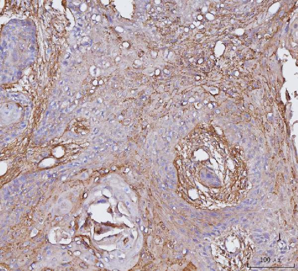 2 - Anti-Integrin alpha V/ITGAV Antibody Picoband™ (monoclonal, 8B10H2) ABO16564