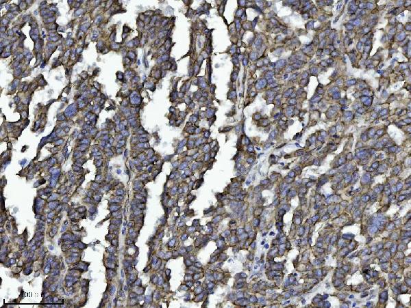 2 - Anti-Drebrin/DBN1 Antibody Picoband™ (monoclonal, 4F6E7) ABO16566