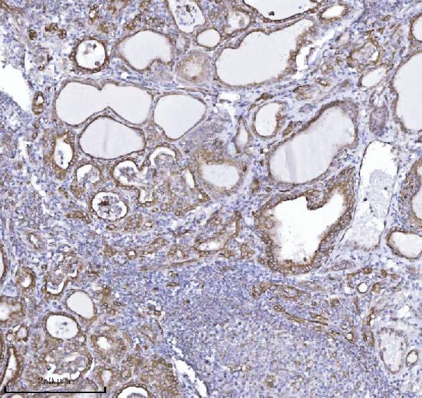2 - Anti-Drebrin/DBN1 Antibody Picoband™ (monoclonal, 4F6E7) ABO16566
